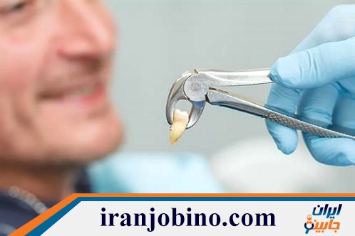 متخصص جراحی دندان عقل در الهیه تهران