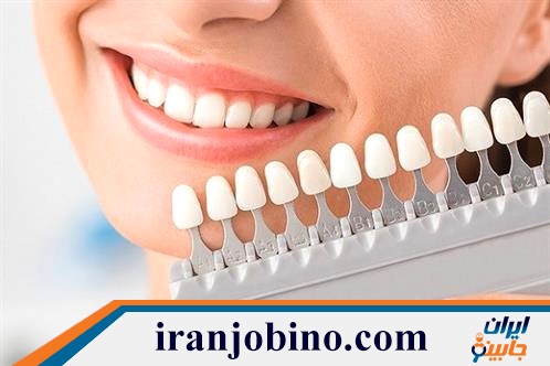 متخصص لمینت دندان در آرارات تهران