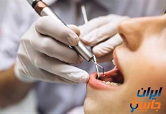 متخصص عصب کشی دندان در شادمهر تهران