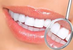 خدمات دندانپزشکی زیبایی شامل چه مواردی می شود؟