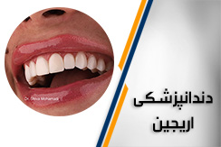 مرکز مجموعه تخصصی دندانپزشکی اریجین گروه کلیه خدمات تخصصی دندانپزشکی زیبایی ، ایمپلنت و درمانی محله نیاوران شمال تهران منطقه 1