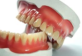 پروتز های دندانی و ایمپلنت